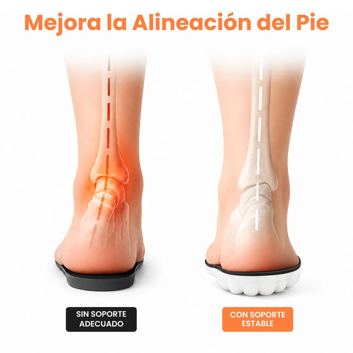 Orthopedische inlegzolen bij hielspoor en fasciitis plantaris