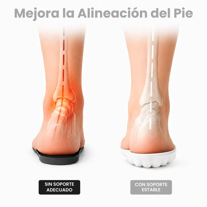 Orthopedische inlegzolen bij hielspoor en fasciitis plantaris