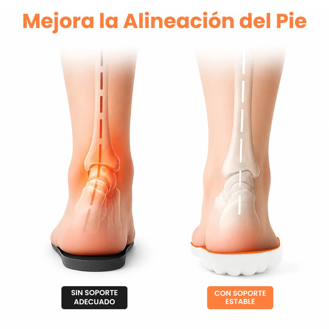 Orthopedische inlegzolen bij hielspoor en fasciitis plantaris