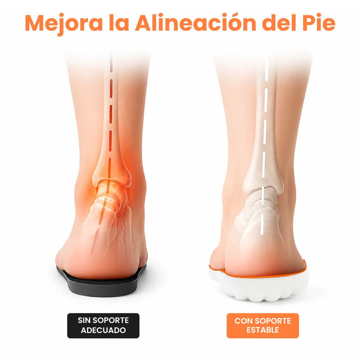 Orthopedische inlegzolen bij hielspoor en fasciitis plantaris