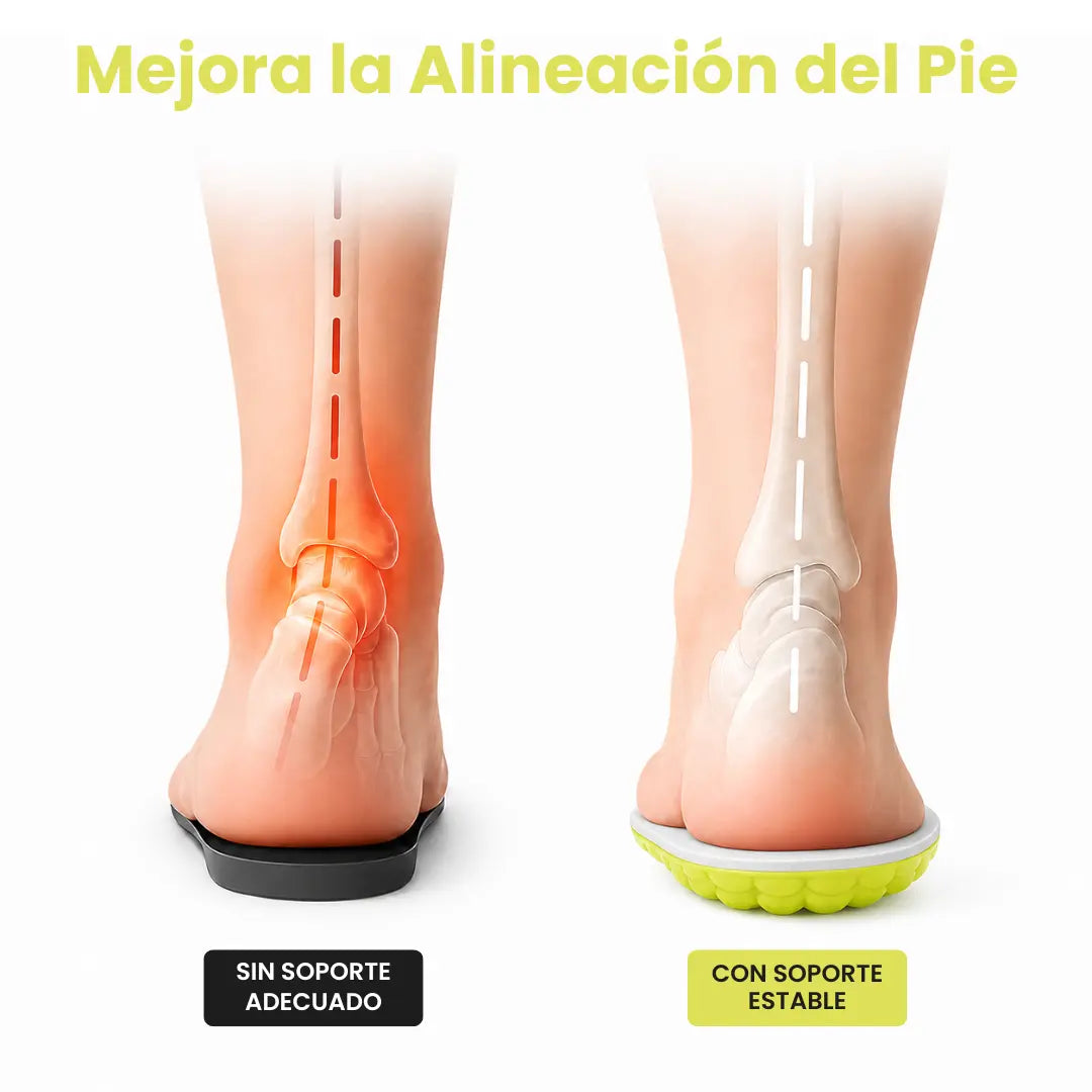 Orthopedische inlegzolen bij hielspoor en fasciitis plantaris